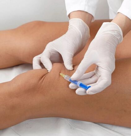 Ozonotherapie